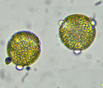 <i>Houstonia caerulea</i> ( Bluet ) 5 petal flower, microscope closeup of pollen